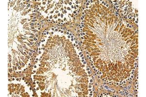 ABIN7095754 and ABIN7099816 at 1/100 staining rat testis tissue by IHC-P. (ERVK-18 抗体)