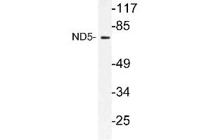 Western blot (WB) analysis of ND5 antibody in extracts from HT-29 cells. (MT-ND5 抗体)