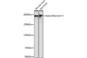 Western blot analysis of extracts of various cell lines, using Neurofilament H antibody (ABIN7268866) at 1:500 dilution. (NEFH 抗体)