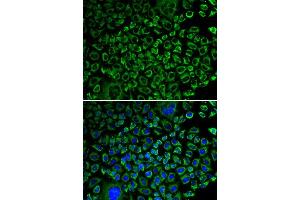 Immunofluorescence analysis of A549 cell using F10 antibody. (Coagulation Factor X 抗体  (AA 235-488))