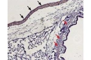 Expression of Sphingosine 1-phosphate receptor 1 in rat lung - Immunohistochemical staining of paraffin embedded rat lung sections using Anti-S1PR1 (EDG1) (extracellular) Antibody (ABIN7043771, ABIN7045270 and ABIN7045271), (1:100). (S1PR1 抗体  (Extracellular, N-Term))