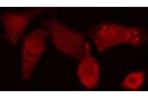 ABIN6276815 staining NIH-3T3 cells by IF/ICC. (POLB 抗体  (C-Term))