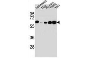Western Blotting (WB) image for anti-Haptoglobin (HP) (AA 299-326), (Middle Region) antibody (ABIN952678)