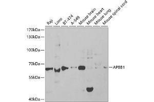 Western Blotting (WB) image for anti-Amyloid beta (A4) Precursor Protein-Binding, Family B, Member 1 (Fe65) (APBB1) (AA 359-708) antibody (ABIN6136973)