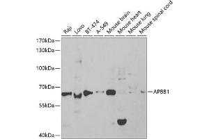 Western blot analysis of extracts of various cell lines, using  antibody (ABIN6129919, ABIN6136973, ABIN6136974 and ABIN6219091) at 1:1000 dilution. (FE65 抗体  (AA 359-708))