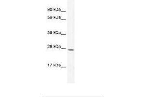 Image no. 2 for anti-General Transcription Factor IIF, Polypeptide 2, 30kDa (GTF2F2) (C-Term) antibody (ABIN6735897) (GTF2F2 抗体  (C-Term))