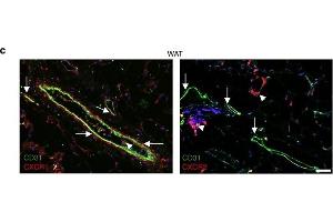 Immunofluorescence (Paraffin-embedded Sections) (IF (p)) image for anti-Chemokine (C-X-C Motif) Receptor 1 (CXCR1) (C-Term) antibody (ABIN2854740)