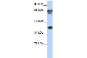 WB Suggested Anti-NKX3-2 Antibody Titration: 0. (NKX3-2 抗体  (N-Term))