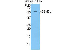 Western Blotting (WB) image for anti-Isocitrate Dehydrogenase 1 (NADP+), Soluble (IDH1) (AA 99-325) antibody (ABIN1859250) (IDH1 抗体  (AA 99-325))