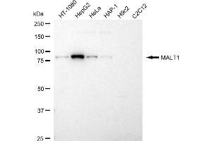 Western blotting analysis using MALT1 antibody (ABIN7799491).