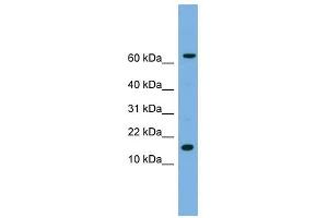 IL1 beta antibody used at 1 ug/ml to detect target protein. (IL-1 beta 抗体  (N-Term))