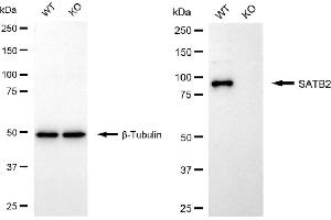 Western blotting analysis using SATB2 antibody (ABIN7800274). (Recombinant SATB2 抗体)