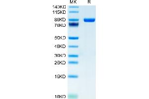 CD5 Protein (CD5) (AA 25-371) (Fc-Avi Tag)