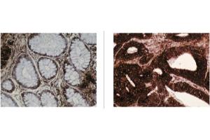 Image no. 1 for anti-Chaperonin Containing TCP1, Subunit 2 (Beta) (CCT2) antibody (ABIN211312) (CCT2 抗体)