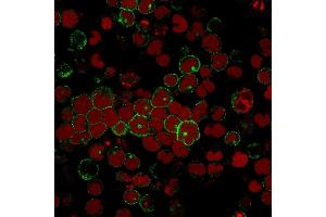Immunofluorescence staining of MOLT-4 cells using CD2 Mouse Monoclonal Antibody (BH1) followed by goat anti-Mouse IgG conjugated to CF488 (green). (CD2 抗体)