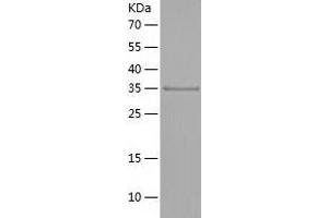 NDUFAF1 Protein (AA 25-327) (His tag)