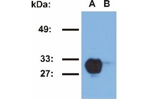 Western blotting analysis of HLA-DR1 in Raji (A) and Jurkat (B) cell lines using MEM-267 antibody. (HLA-DR1 抗体)