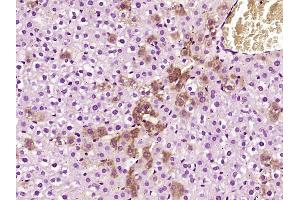 Immunohistochemistry (Paraffin-embedded Sections) (IHC (p)) image for anti-serpin Peptidase Inhibitor, Clade A (Alpha-1 Antiproteinase, Antitrypsin), Member 1 (SERPINA1) (AA 101-200) antibody (ABIN724835)