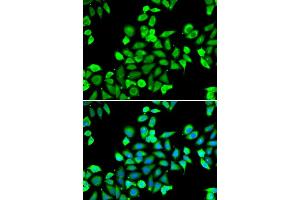 Immunofluorescence analysis of A549 cell using CDC16 antibody. (CDC16 抗体)