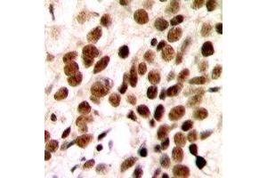 Immunohistochemistry (IHC) image for anti-General Transcription Factor IIH, Polypeptide 1, 62kDa (GTF2H1) (N-Term) antibody (ABIN7303064)