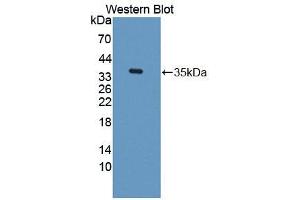 Western blot analysis of the recombinant protein. (TKT 抗体  (AA 1-286))