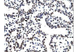 Image no. 1 for anti-LIM Homeobox 3 (LHX3) (AA 211-260) antibody (ABIN202432) (LHX3 抗体  (AA 211-260))