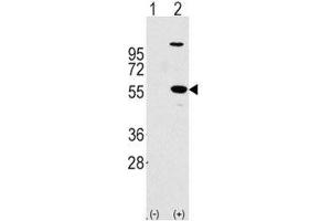 Western blot analysis of ALDH1A1 antibody and 293 cell lysate (2 ug/lane) either nontransfected (Lane 1) or transiently transfected with the ALDH1A1 gene (2).
