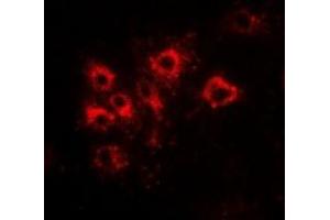 Immunofluorescent analysis of Tapasin staining in Hela cells. (TAPBP 抗体  (full length))