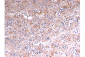 Formalin-fixed, paraffin-embedded human Adrenal stained with Adipophilin Recombinant Mouse Monoclonal Antibody (rADFP/1493). (Recombinant ADRP 抗体  (AA 249-376))