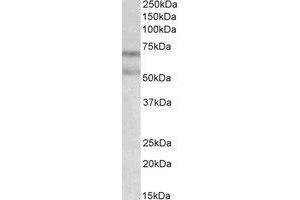 Western Blotting (WB) image for anti-Cannabinoid Receptor 1 (CNR1) (AA 77-91) antibody (ABIN793332) (CNR1 抗体  (AA 77-91))