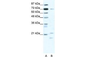 WB Suggested Anti-BTF3 Antibody Titration:  1. (BTF3 抗体  (Middle Region))