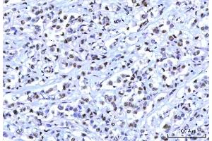 IHC analysis of RBM15B using anti-RBM15B antibody (ABIN7600219). (RBM15B 抗体  (AA 164-890))