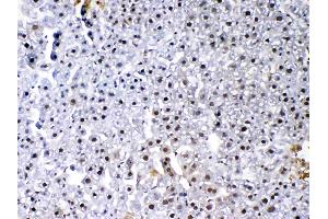 IHC analysis of VEGF Receptor 3 using anti-VEGF Receptor 3 antibody . (FLT4 抗体  (AA 25-259))