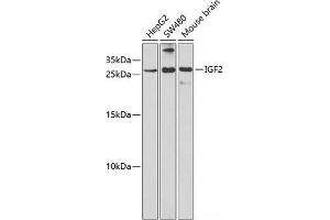Western blot analysis of extracts of various cell lines using IGF2 Polyclonal Antibody at dilution of 1:1000. (IGF2 抗体)