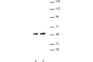PAX5 antibody (pAb) tested by Western blot. (PAX5 抗体  (N-Term))