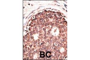 Immunohistochemistry (Paraffin-embedded Sections) (IHC (p)) image for anti-Matrix Metallopeptidase 9 (Gelatinase B, 92kDa Gelatinase, 92kDa Type IV Collagenase) (MMP9) (AA 644-673), (C-Term) antibody (ABIN390154)