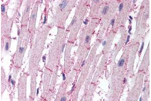 Human Heart (formalin-fixed, paraffin-embedded) stained with ATG4B antibody ABIN295502 at 10 ug/ml followed by biotinylated goat anti-rabbit IgG secondary antibody ABIN481713, alkaline phosphatase-streptavidin and chromogen. (ATG4B 抗体  (AA 350-400))