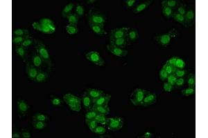Immunofluorescent analysis of HepG2 cells using ABIN7159609 at dilution of 1:100 and Alexa Fluor 488-congugated AffiniPure Goat Anti-Rabbit IgG(H+L) (MBD1 抗体  (AA 106-355))