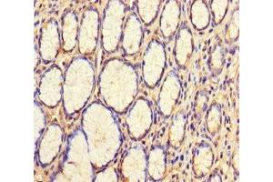 Immunohistochemistry of paraffin-embedded human stomach tissue using ABIN7175770 at dilution of 1:100 (WDR54 抗体  (AA 1-334))