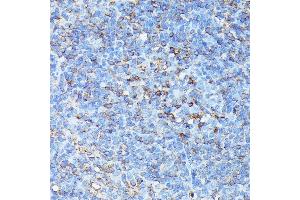 Immunohistochemistry of paraffin-embedded mouse spleen using CXCR1 antibody (ABIN7266317) at dilution of 1:100 (40x lens). (CXCR1 抗体  (AA 250-350))