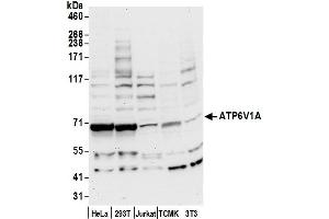 Western Blotting (WB) image for anti-ATPase, H+ Transporting, Lysosomal 70kDa, V1 Subunit A (ATP6V1A) (AA 567-617) antibody (ABIN7450014)