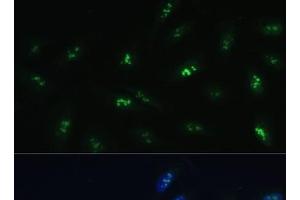Immunofluorescence analysis of U-2 OS cells using HNF4G Polyclonal Antibody at dilution of 1:100 (40x lens). (HNF4 gamma 抗体)