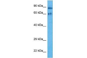 Host:  Rabbit  Target Name:  RIPK4  Sample Tissue:  Human HT1080 Whole Cell  Antibody Dilution:  1ug/ml