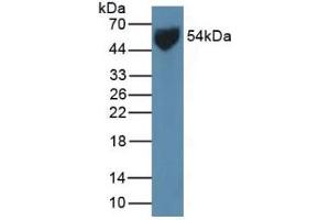 Western Blotting (WB) image for Solute Carrier Family 2 (Facilitated Glucose Transporter), Member 1 (SLC2A1) ELISA Kit (ABIN6574259)