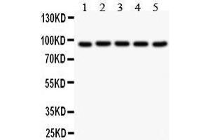 Western Blotting (WB) image for anti-Villin 1 (VIL1) (AA 770-799), (C-Term) antibody (ABIN3042343) (Villin 1 抗体  (C-Term))