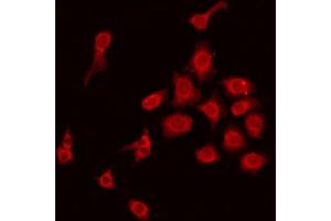 ABIN6275220 staining HepG2 by IF/ICC. (MBL2 抗体  (N-Term))
