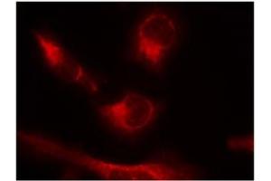 Image no. 2 for anti-Microtubule-Associated Protein tau (MAPT) (pSer356) antibody (ABIN319220) (MAPT 抗体  (pSer356))