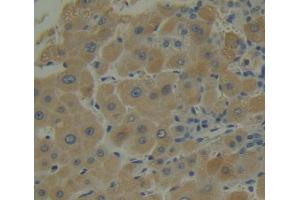 IHC-P analysis of liver tissue, with DAB staining. (SNAPIN 抗体  (AA 2-136))
