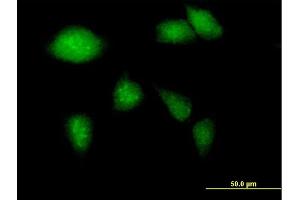 Immunofluorescence of purified MaxPab antibody to GCK on HeLa cell. (GCK 抗体  (AA 1-465))