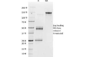 SDS-PAGE Analysis Purified Vitronectin Receptor Mouse Monoclonal Antibody (23C6). (CD51 抗体)